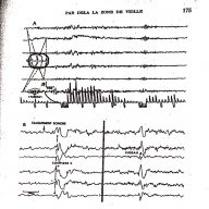 Extrait de l'ouvrage de Grey Walter, Le Cerveau Vivant 2